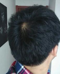 没头发的图片,揭秘现代潮流下的“光头”风尚